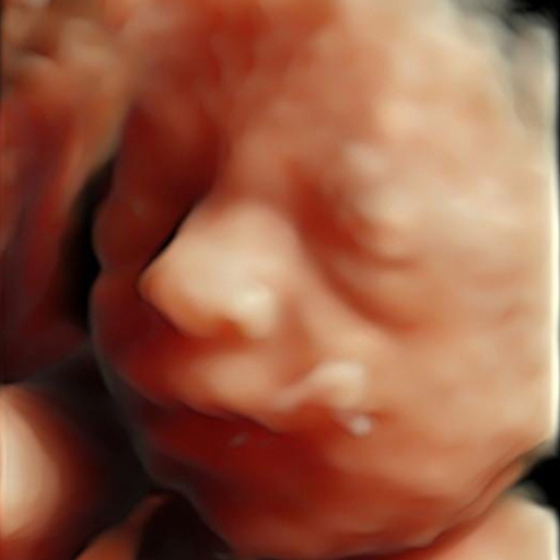 Real customer image 3