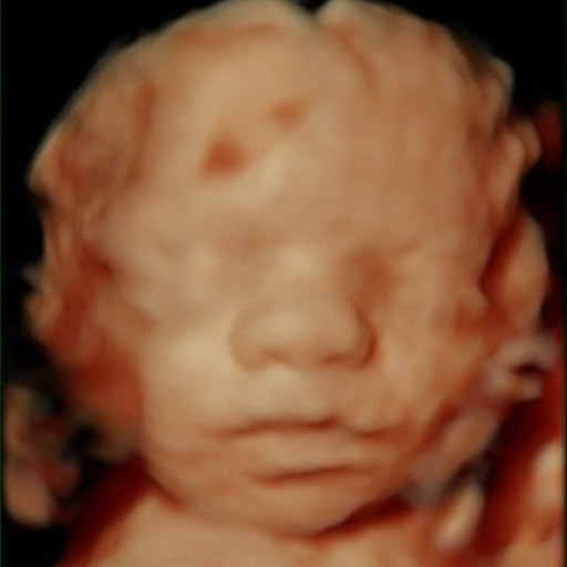 Original ultrasound 1
